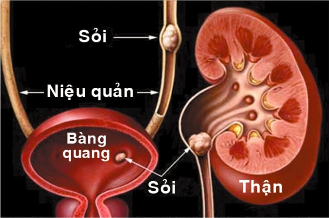 Soi than to 6mm phai lam the nao?-hinh-anh-1