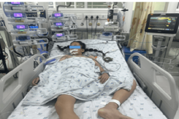 tre-than-met-khi-choi-the-tao-co-nguy-co-mac-benh-tim-cuc-hiem-hinh-anh.png