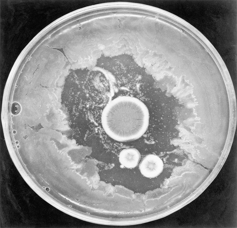 Alexander Fleming và góc khuất của ‘phép màu’ penicillin Điều trị cho trợ lí bất thành (6)