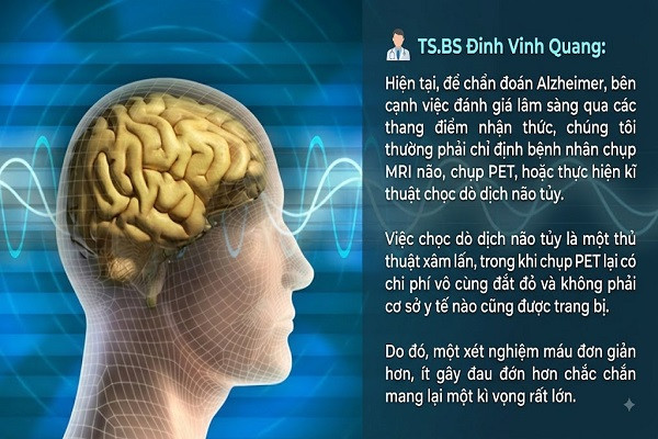 xet-nghiem-mau-phat-hien-Alzheimer-truoc-ca-thap-ki-cohoi-vang-hay-con-dao-hai-luoi-hinh-an 1