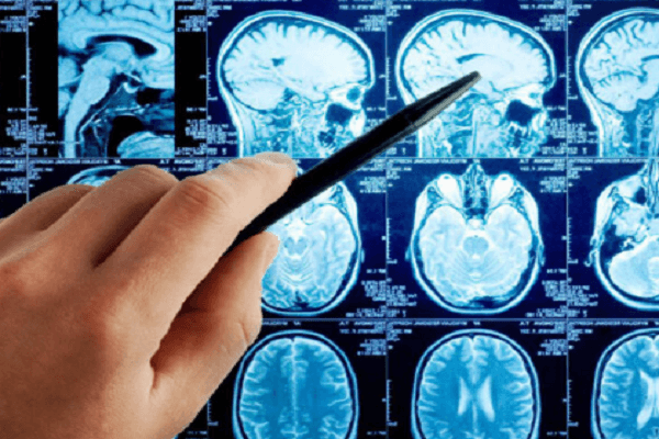 mri-binhthuong-co-chac-khong-phai-dotquy-hinh-anh.png