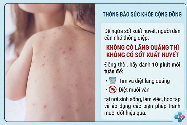 vien-pasteur-tphcm-canh-bao-virut-ev71-bung-phat-cu-dup-dich-benh-de-doa-mua-tuu-truong-hinh-anh 1
