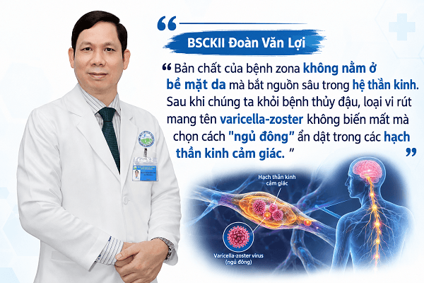 noi-am-anh-sau-zona-than-kinh-da-da-lanh-vi-sao-con-dau-van-gam-nham-nguoi-benh-hinh-anh.png