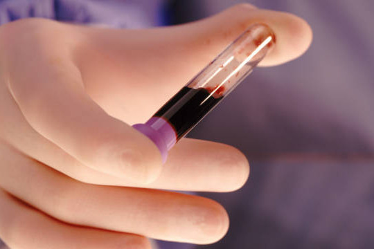 Xét nghiệm máu có thể dự đoán ý định tự tử?