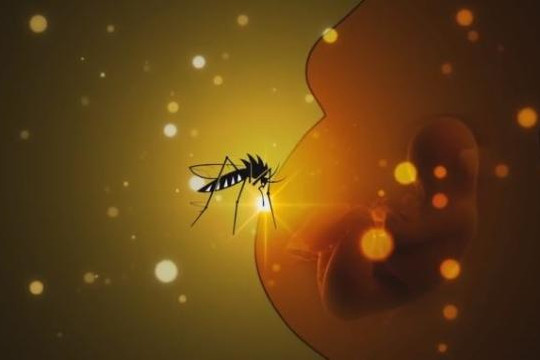 Cách phòng chống vi rút Zika gây bệnh đầu nhỏ ở thai nhi