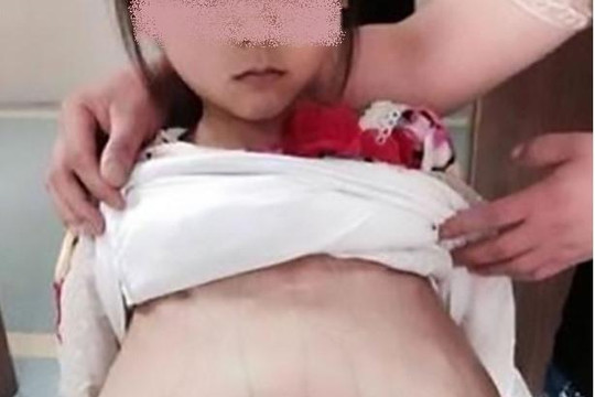 Bé gái 12 tuổi mang thai ở Trung Quốc nghi bị bắt cóc là người Việt Nam