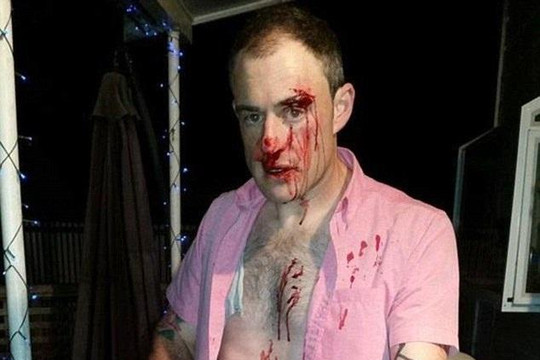 Một người đàn ông bị tấn công chỉ vì mặc áo hồng