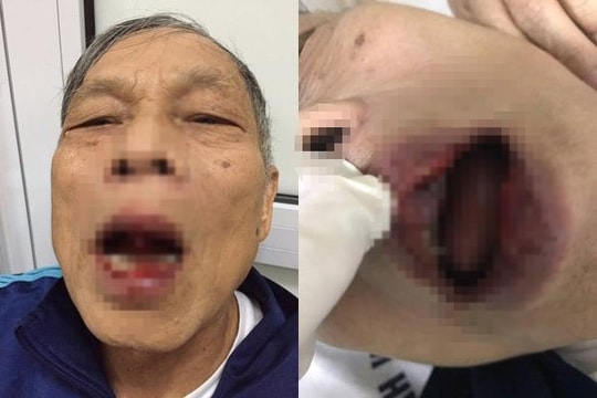 Chủ tịch HN chỉ đạo tạm đình chỉ Phó giám đốc đánh tiến sĩ 76 tuổi