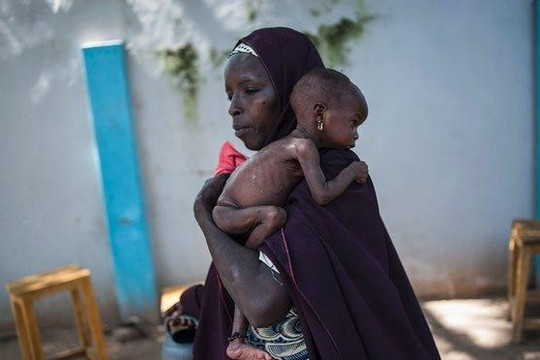 75.000 trẻ em Nigeria có nguy cơ chết đói trong vài tháng tới 