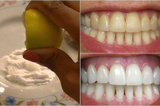 Nếu muốn răng trắng sáng, đều như hạt bắp, bạn nhất định phải làm điều này mỗi tối
