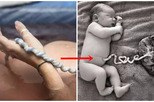 Bộ ảnh chụp em bé mới sinh còn giữ nguyên dây rốn khiến ai cũng xúc động