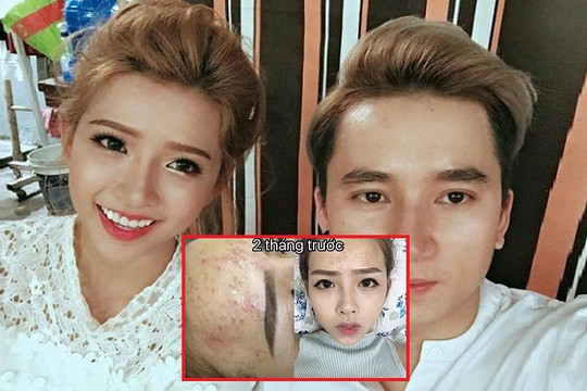 Bạn gái Phan Mạnh Quỳnh gây giật mình vì nhan sắc không photoshop