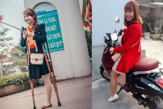 Cuộc sống khó tin của cô gái Bắc Giang một chân sau 8 tháng gây bão mạng