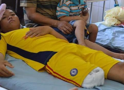 Đồng Tháp: Bệnh nhân 16 tuổi phải tháo khớp chân vì bệnh viện ‘neo’ lại