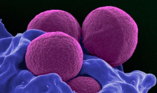 Thật bất ngờ: con người có thể miễn dịch với công nghệ chỉnh sửa gien CRISPR