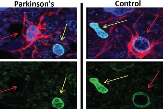 Loại bỏ các tế bào già cỗi trong não để chữa bệnh Parkinson và chống lão hóa