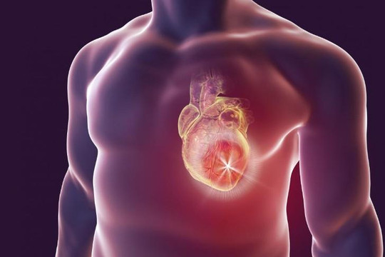 Thuốc chữa gút có tác dụng đối với chứng suy tim
