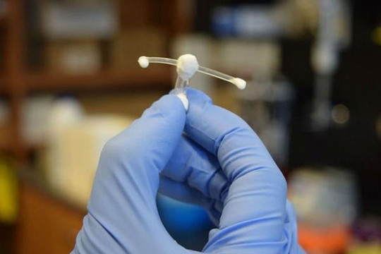 Phát triển thiết bị cấy ghép bảo vệ phụ nữ khỏi lây nhiễm HIV