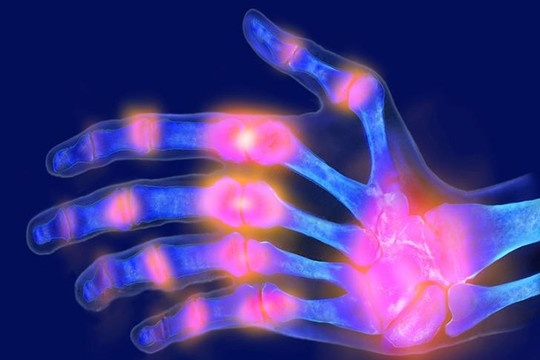 Găng tay chụp cộng hưởng từ được các mô mềm khi tay cử động