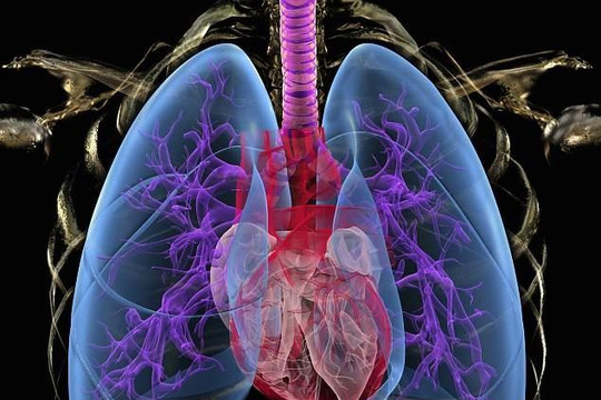 Thuốc chống đông máu giúp người bệnh phổi tắc nghẽn mạn tính dễ thở
