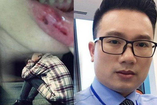 Nam sinh bị bạn gái bỏ vì ủng hộ MC Minh Tiệp đánh em vợ và đòi 'táng con sấp mặt'