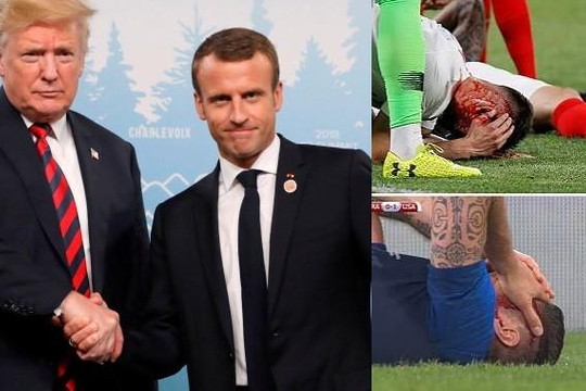 Tổng thống Pháp - Mỹ nghiến răng bắt tay, cầu thủ 2 đội trên sân đổ máu