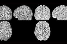 Có thể nhận dạng người qua cấu trúc não bộ