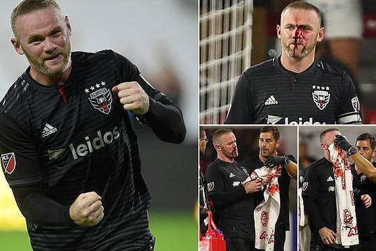 Rooney máu chảy đầm đìa trên mặt, bị gãy mũi phải rời sân đi cấp cứu