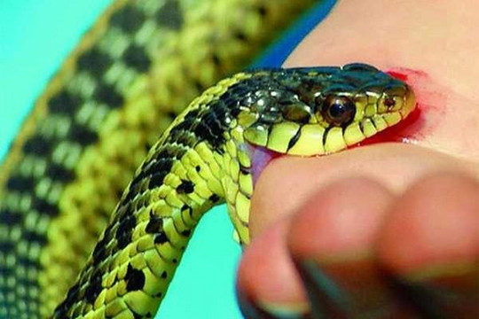 Bé gái 7 tuổi bị phù toàn thân do rắn độc cắn