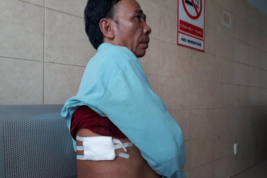 2 'hiệp sĩ' bị đâm trọng thương trong lúc truy bắt nghi can trộm cắp ở Đồng Nai