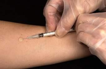 Thử nghiệm lâm sàng giai đoạn 2 vắcxin ngừa lao
