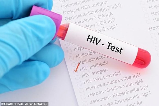 Phát hiện gien Tat, thủ phạm giúp vi rút HIV lẩn trốn