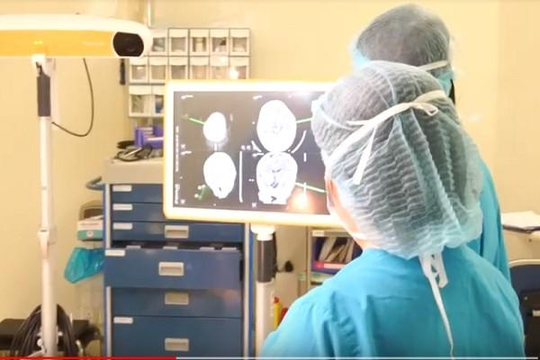   Dùng công nghệ định vị 3D cứu bé gái 23 tháng tuổi thoát khỏi u mạch máu não