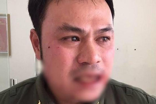 Công an tạm giữ kẻ côn đồ đánh gãy răng nhân viên an ninh sân bay Nội Bài