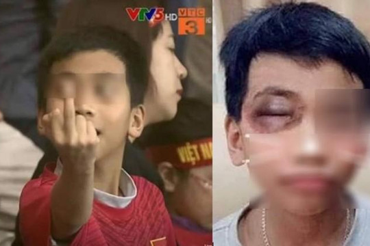 Thực hư cậu bé giơ ngón thối khi U23 Việt Nam thắng Thái Lan bị bố đấm bầm mắt?