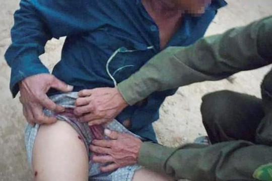 Hà Tĩnh: Tạm giữ kẻ bắn người đàn ông đi rừng trọng thương