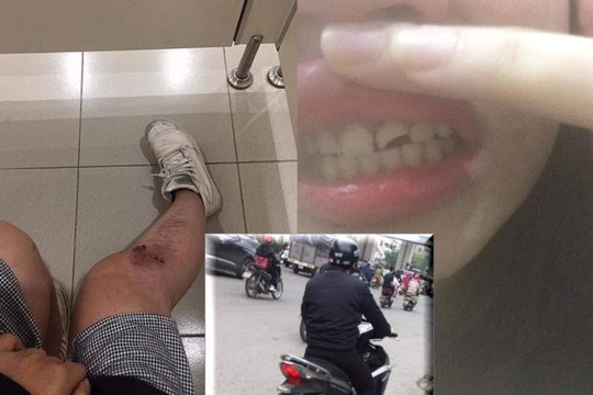 Thanh niên Thanh Hóa bị 3 cô gái Hà Nội tố cố tình tông xe rồi sờ vùng kín