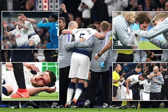 Ảnh Jan Vertonghen chấn thương đầu rợn người ở trận Tottenham thua Ajax 