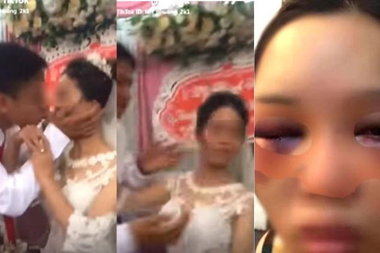 Sự thật chuyện cô dâu bị chú rể đánh bầm mặt vì từ chối hôn ở đám cưới?