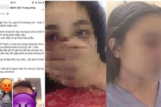 Bác sĩ da liễu Huế bị tố gạ tình, đánh nữ sinh thực tập bầm dập: Nhiều bài bị report