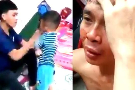 Gã trai hé lộ điều bất ngờ khi bị dân xã hội đánh tóe máu vì tát và dọa giết con nhỏ