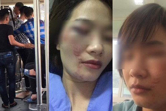 4 thanh niên đánh nữ phụ xe buýt nhập viện ngày 20.10: ‘Hèn hạ chưa từng thấy’
