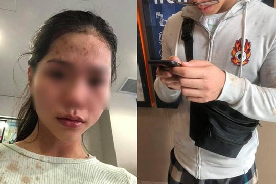Cô gái gốc Việt và anh trai bị hất đồ uống, hành hung ở Úc vì đeo khẩu trang