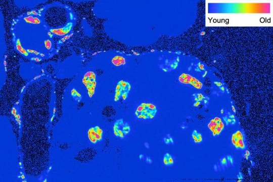 Phát hiện các tế bào có tuổi ngang tuổi đời của cơ thể