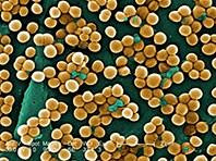 Phát triển kháng sinh chống Staphylococcus aureus kháng thuốc