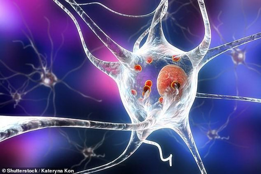 Những người trẻ mắc Parkinson có thể bị tổn thương tế bào não từ trong bụng mẹ