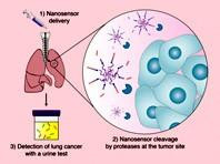 Mỹ phát triển phương pháp chẩn đoán ung thư phổi qua xét nghiệm nước tiểu
