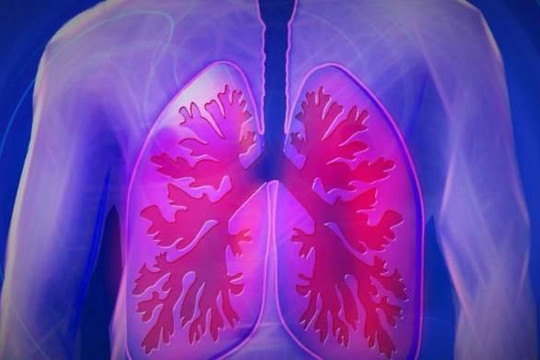 Ô nhiễm không khí gây bệnh phổi không thua gì hút thuốc