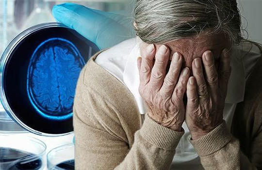 Mê sảng sau phẫu thuật có thể báo trước nguy cơ phát triển bệnh Alzheimer