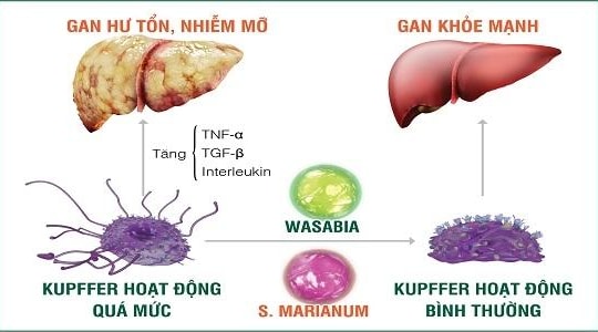 Gan nhiễm mỡ - Bệnh lý nguy hiểm không thể chủ quan